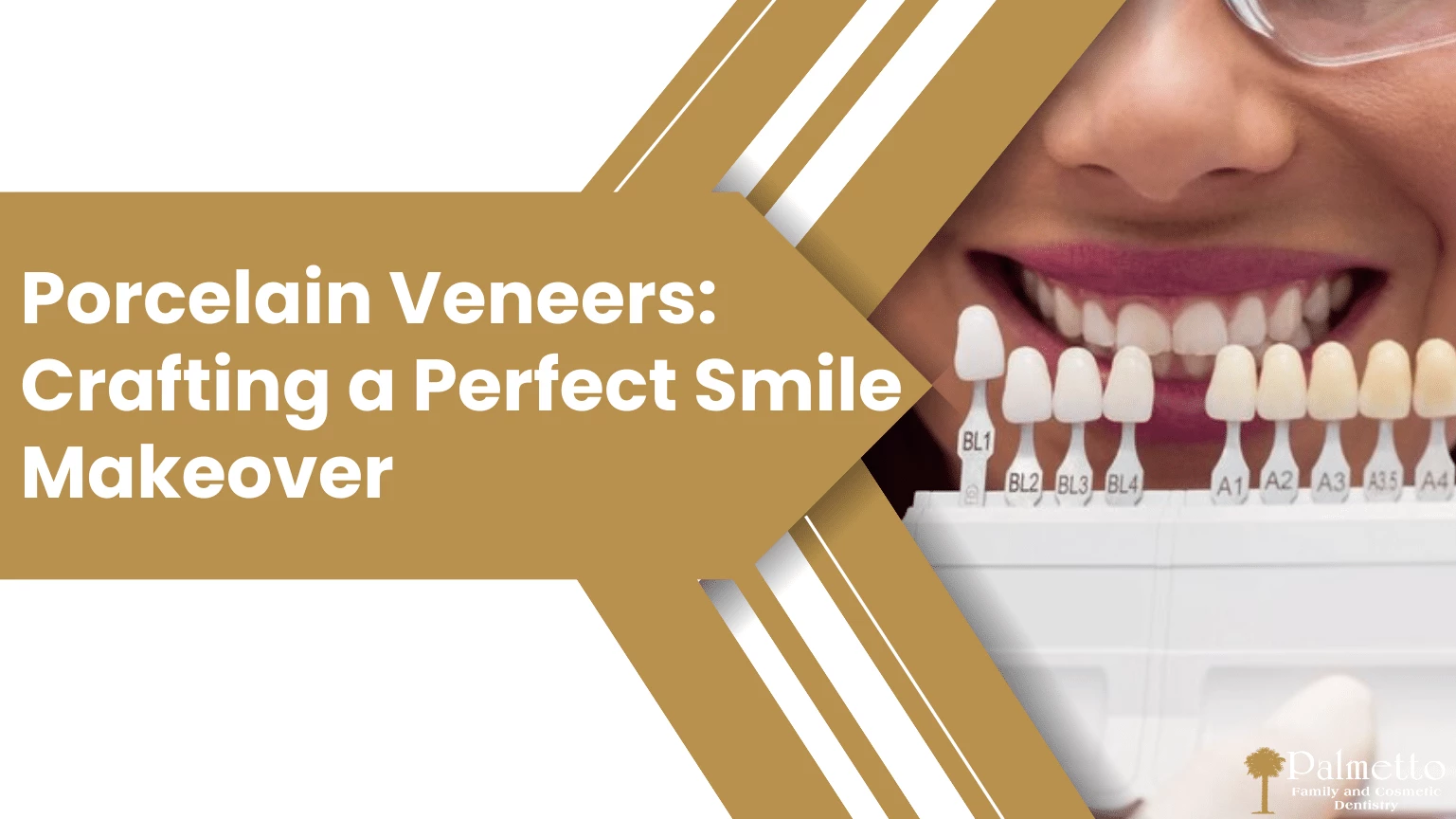 Porcelain Veneers Crafting a Perfect Smile Makeover