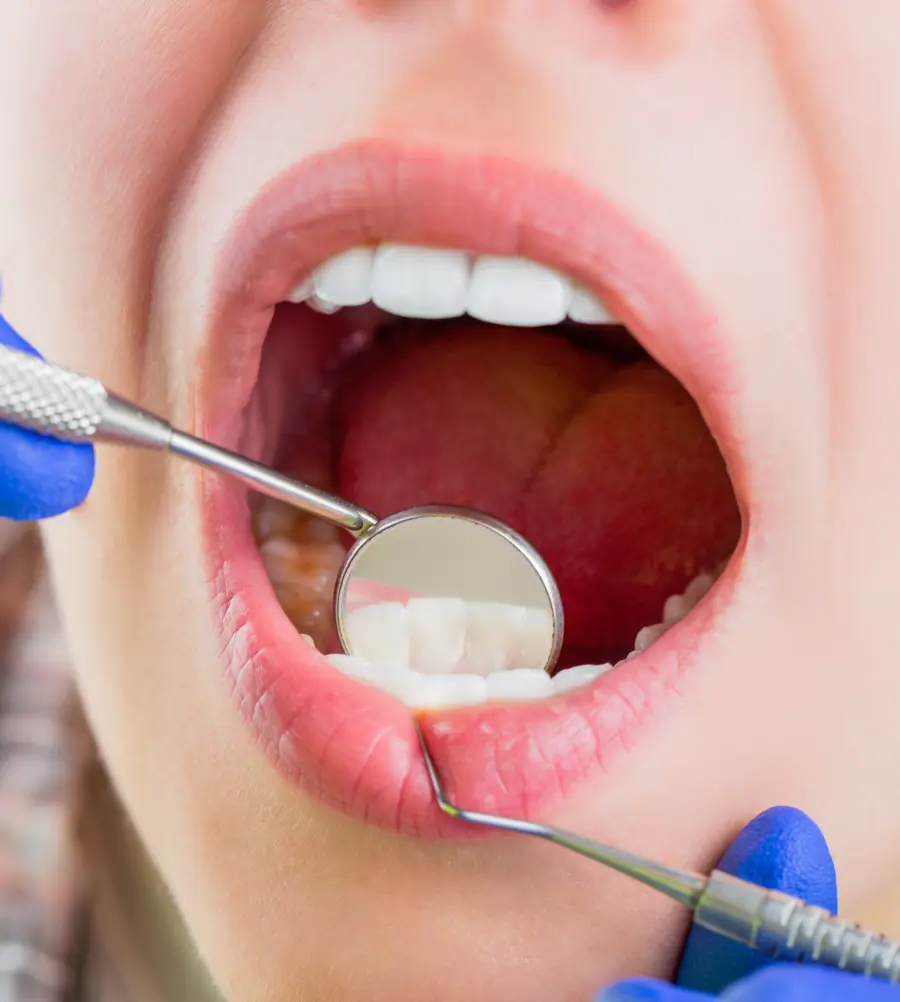 checkup dental