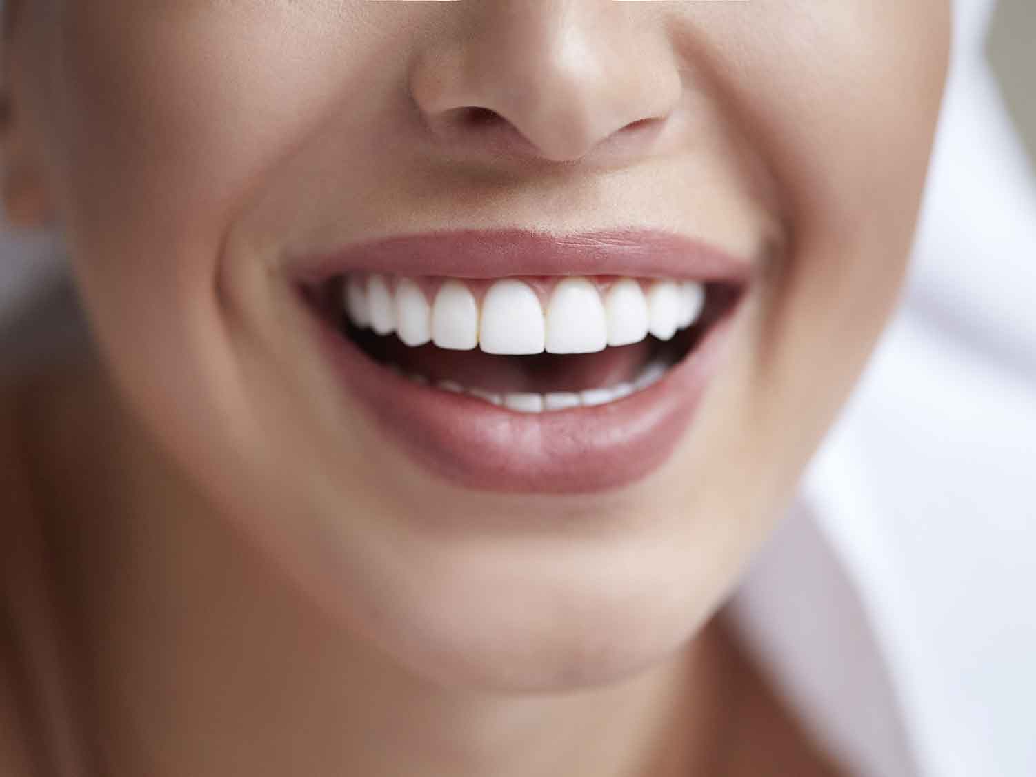 teeth whitening smile close up