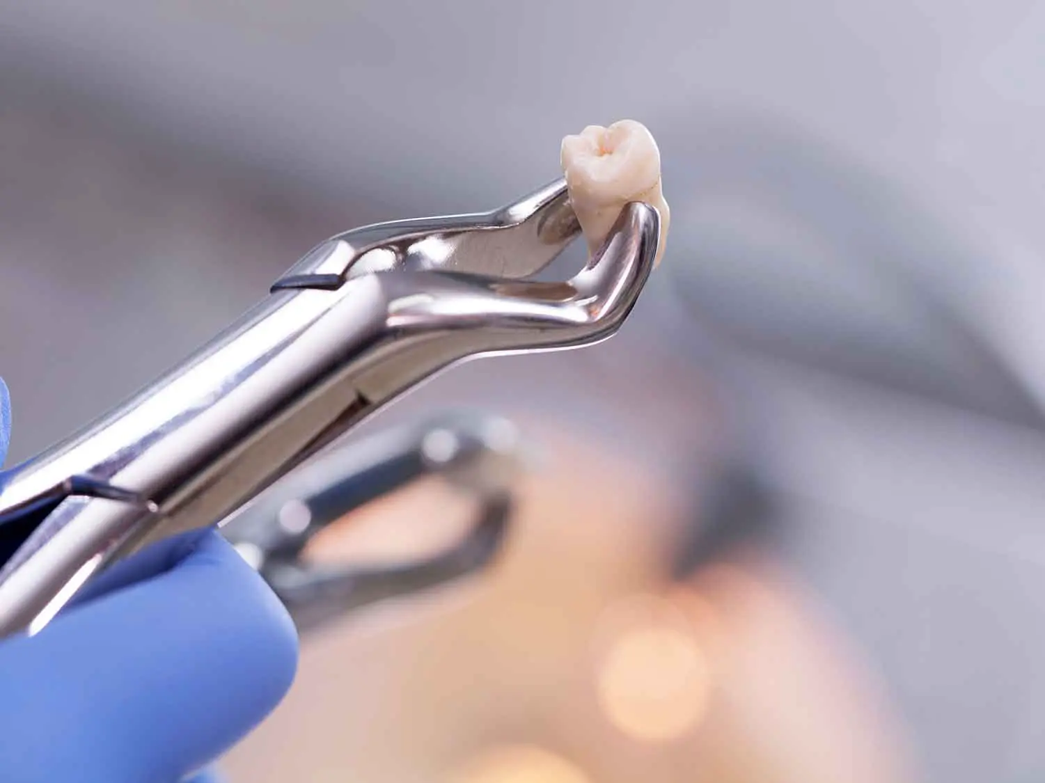 tooth-extraction-blurred-background